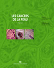 Les cancers de la peau img_livre